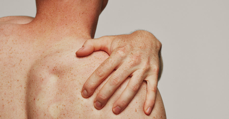 Derfor er blødgørende hudpleje vigtig, når du har eksem