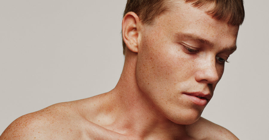 6 myter om psoriasis