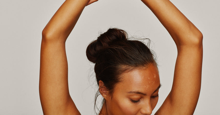 Kan man nedsætte risikoen for børneeksem?