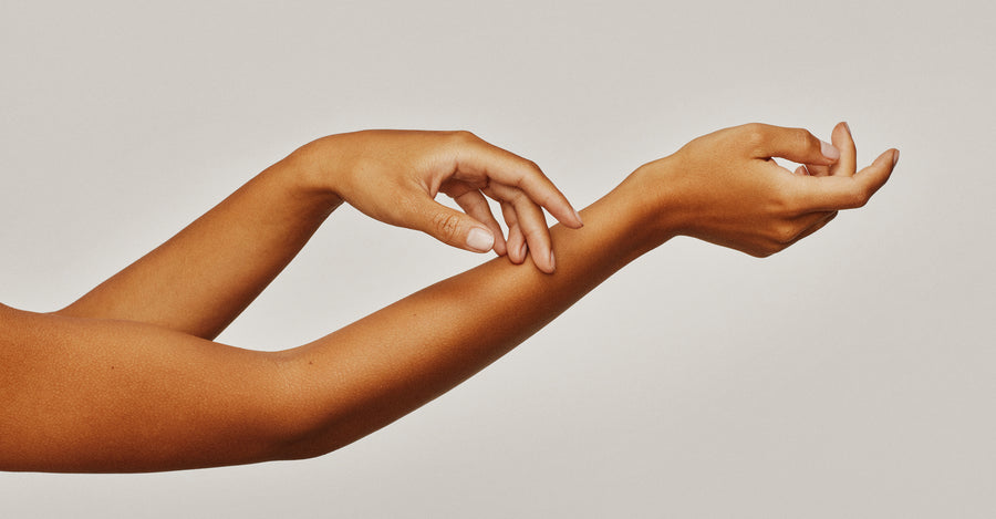 6 triggere du skal undgå for at forhindre, at din psoriasis blusser op