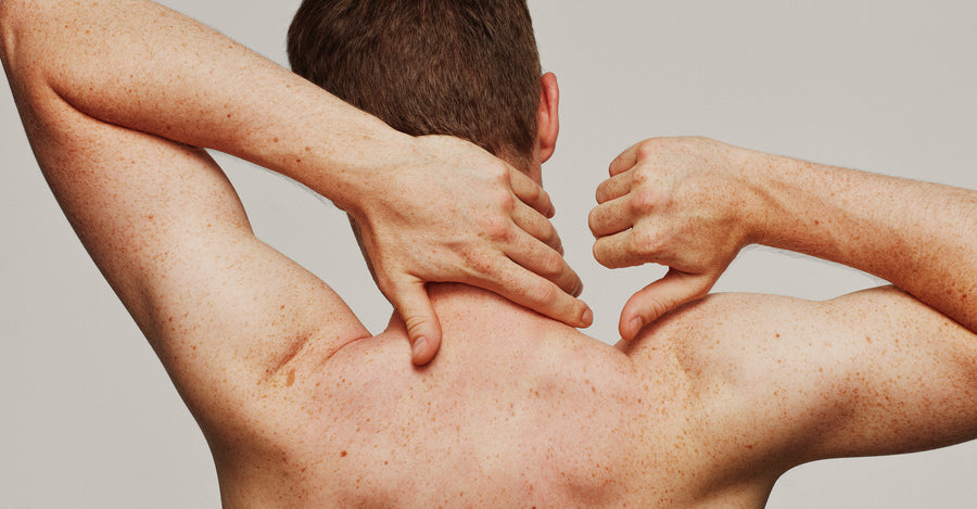 Hvad er atopisk eksem?